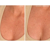 Chest Sio Chestlift Reusable Wrinkle Smoothing Patches